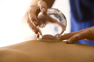 Cupping_1