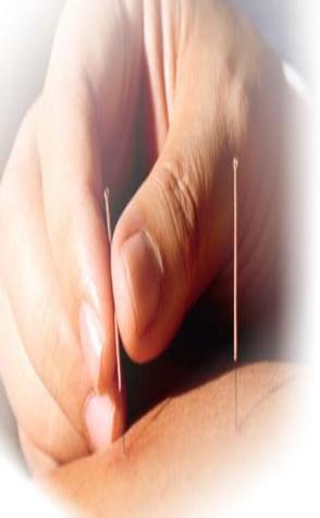 Acupuncture_3